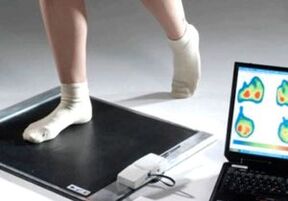 Diagnosis of hallux valgus