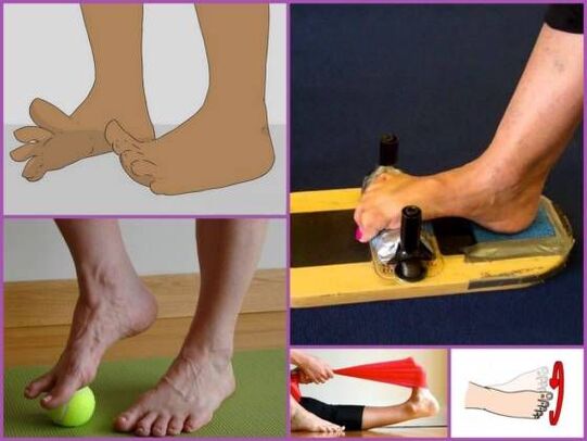Exercise therapy for planovalgus foot deformity