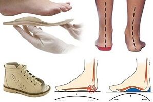 orthopedic shoes for hallux valgus in a child