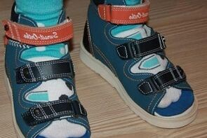 wear sandals for hallux valgus in a child
