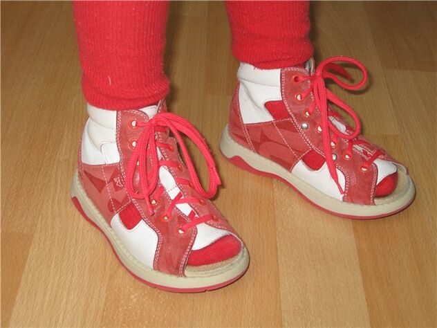 shoes for children suffering from hallux valgus
